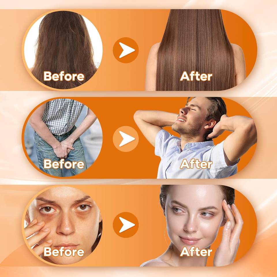 Private Label Pumpkin Seed Oil Gummies with Saw Palmetto Extract Hair, Skin & Nails Supplement for Men & Women